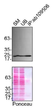 Immunoprecipitation - Anti-Peroxiredoxin 1/PAG antibody [EPR5434] - BSA and Azide free (AB211538), expandable thumbnail