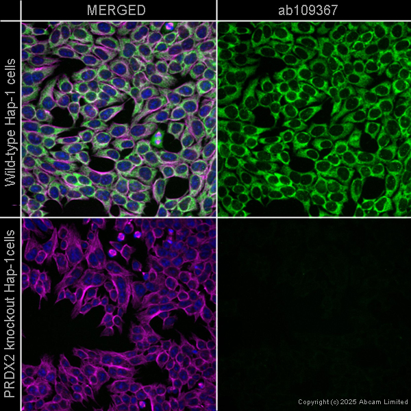 Immunocytochemistry/ Immunofluorescence - Anti-Peroxiredoxin 2/PRP antibody [EPR5154] (AB109367)