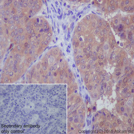 Immunohistochemistry (Formalin/PFA-fixed paraffin-embedded sections) - Anti-Peroxiredoxin 2/PRP antibody [EPR5154] (AB109367)