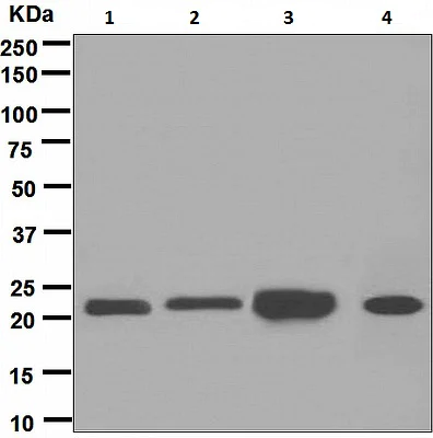 Western blot - Anti-Peroxiredoxin 2/PRP antibody [EPR5154] (AB109367)