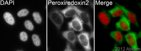 Immunocytochemistry/ Immunofluorescence - Anti-Peroxiredoxin 2/PRP antibody [EPR5154] - BSA and Azide free (ab227988), expandable thumbnail