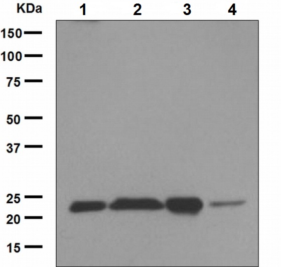 Western blot - Anti-Peroxiredoxin 2/PRP antibody [EPR5155] (AB133481), expandable thumbnail