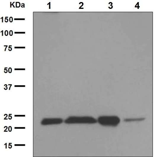 Western blot - Anti-Peroxiredoxin 2/PRP antibody [EPR5155] (AB133481)