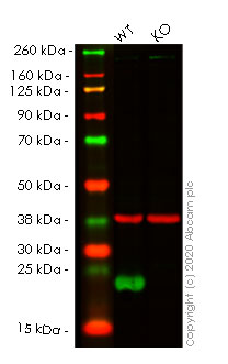 Western blot - Anti-Peroxiredoxin 2/PRP antibody [EPR5155] (AB133481), expandable thumbnail