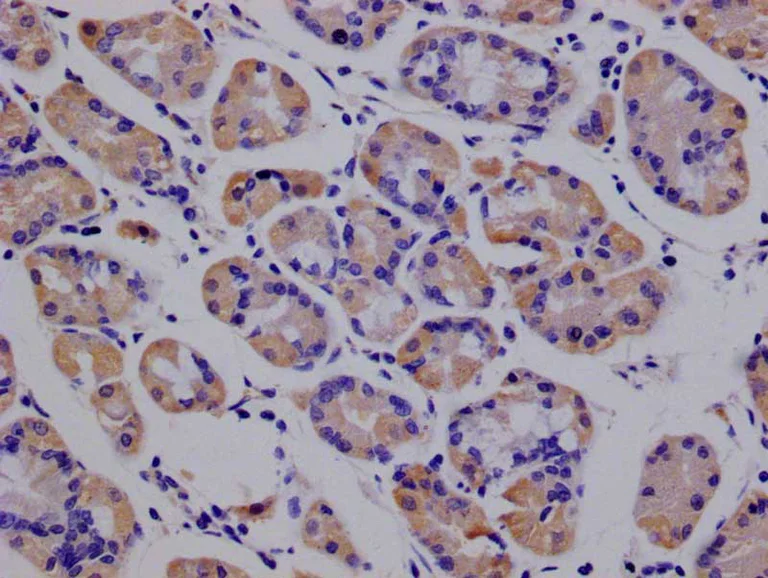 Immunohistochemistry (Formalin/PFA-fixed paraffin-embedded sections) - Anti-Peroxiredoxin 3/PRDX3 antibody [14E2] (AB314176)