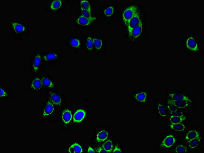Immunocytochemistry/ Immunofluorescence - Anti-Peroxiredoxin 3/PRDX3 antibody (AB222807)