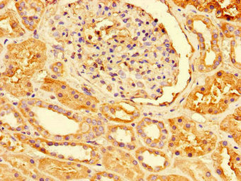 Immunohistochemistry (Formalin/PFA-fixed paraffin-embedded sections) - Anti-Peroxiredoxin 3/PRDX3 antibody (AB222807), expandable thumbnail