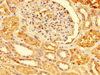 Immunohistochemistry (Formalin/PFA-fixed paraffin-embedded sections) - Anti-Peroxiredoxin 3/PRDX3 antibody (AB222807)
