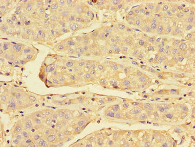 Immunohistochemistry (Formalin/PFA-fixed paraffin-embedded sections) - Anti-Peroxiredoxin 3/PRDX3 antibody (AB222807), expandable thumbnail