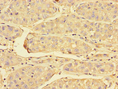 Immunohistochemistry (Formalin/PFA-fixed paraffin-embedded sections) - Anti-Peroxiredoxin 3/PRDX3 antibody (AB222807)