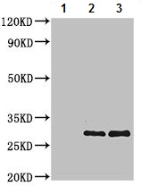 Immunoprecipitation - Anti-Peroxiredoxin 3/PRDX3 antibody (AB222807), expandable thumbnail