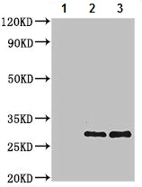 Immunoprecipitation - Anti-Peroxiredoxin 3/PRDX3 antibody (AB222807)