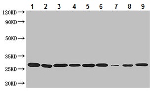 Western blot - Anti-Peroxiredoxin 3/PRDX3 antibody (AB222807), expandable thumbnail