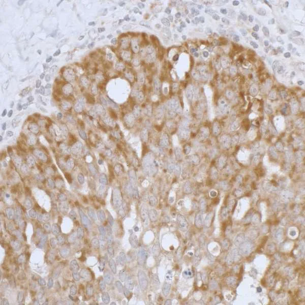 Immunohistochemistry (Formalin/PFA-fixed paraffin-embedded sections) - Anti-Peroxiredoxin 3/PRDX3 antibody (AB264354)