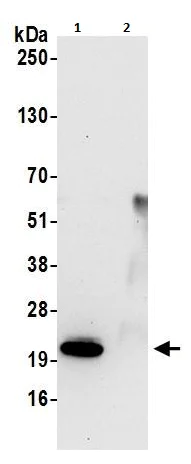 Immunoprecipitation - Anti-Peroxiredoxin 3/PRDX3 antibody (AB264354)