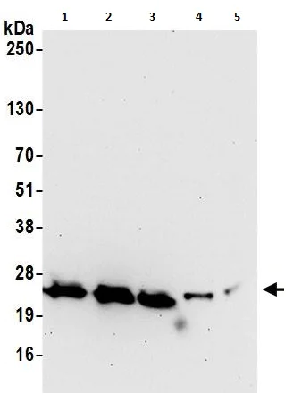 Western blot - Anti-Peroxiredoxin 3/PRDX3 antibody (AB264354)