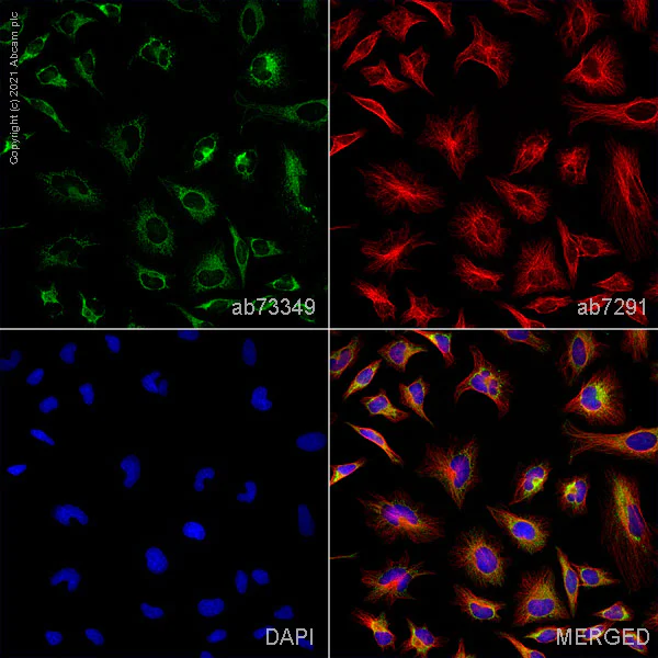 Immunocytochemistry/ Immunofluorescence - Anti-Peroxiredoxin 3/PRDX3 antibody (AB73349)