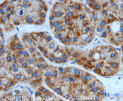 Immunohistochemistry (Formalin/PFA-fixed paraffin-embedded sections) - Anti-Peroxiredoxin 3/PRDX3 antibody (AB73349)
