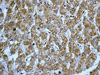 Immunohistochemistry (Formalin/PFA-fixed paraffin-embedded sections) - Anti-Peroxiredoxin 3/PRDX3 antibody [EPR8114] (AB129206), expandable thumbnail