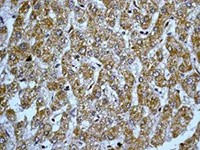 Immunohistochemistry (Formalin/PFA-fixed paraffin-embedded sections) - Anti-Peroxiredoxin 3/PRDX3 antibody [EPR8114] (AB129206)