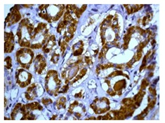 Immunohistochemistry (Formalin/PFA-fixed paraffin-embedded sections) - Anti-Peroxiredoxin 3/PRDX3 antibody [EPR8114] (ab129206), expandable thumbnail