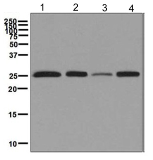 Western blot - Anti-Peroxiredoxin 3/PRDX3 antibody [EPR8114] (AB129206), expandable thumbnail