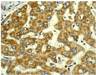 Immunohistochemistry (Formalin/PFA-fixed paraffin-embedded sections) - Anti-Peroxiredoxin 3/PRDX3 antibody [EPR8115] (ab128953), expandable thumbnail