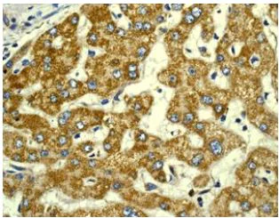 Immunohistochemistry (Formalin/PFA-fixed paraffin-embedded sections) - Anti-Peroxiredoxin 3/PRDX3 antibody [EPR8115] - BSA and Azide free (AB234918)