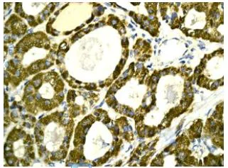 Immunohistochemistry (Formalin/PFA-fixed paraffin-embedded sections) - Anti-Peroxiredoxin 3/PRDX3 antibody [EPR8115] - BSA and Azide free (AB234918)