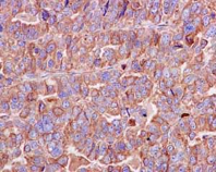 Immunohistochemistry (Formalin/PFA-fixed paraffin-embedded sections) - Anti-Peroxiredoxin 4 antibody [EPR15458(B)] (AB184167), expandable thumbnail