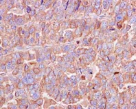 Immunohistochemistry (Formalin/PFA-fixed paraffin-embedded sections) - Anti-Peroxiredoxin 4 antibody [EPR15458(B)] (AB184167)