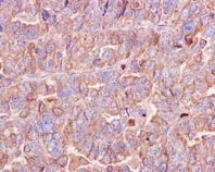 Immunohistochemistry (Formalin/PFA-fixed paraffin-embedded sections) - Anti-Peroxiredoxin 4 antibody [EPR15458(B)] - BSA and Azide free (AB245772)