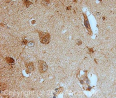 Immunohistochemistry (Formalin/PFA-fixed paraffin-embedded sections) - Anti-Peroxiredoxin 6 antibody (AB73350)