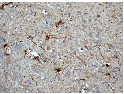Immunohistochemistry (Formalin/PFA-fixed paraffin-embedded sections) - Anti-Peroxiredoxin 6 antibody [EPR3754] - BSA and Azide free (AB240057)