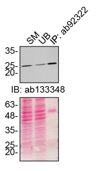 Immunoprecipitation - Anti-Peroxiredoxin 6 antibody [EPR3755] (AB92322)