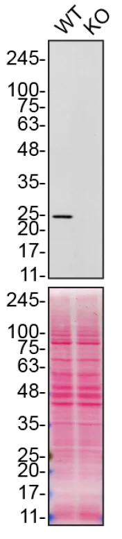 Western blot - Anti-Peroxiredoxin 6 antibody [EPR3755] (AB92322)
