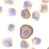 Immunocytochemistry/ Immunofluorescence - Anti-PERP antibody (AB5986), expandable thumbnail