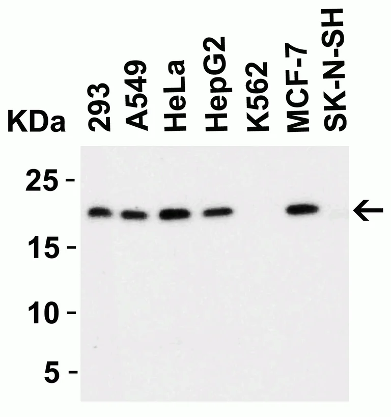 Western blot - Anti-PERP antibody (AB5986)