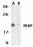 Western blot - Anti-PERP antibody (AB5986), expandable thumbnail