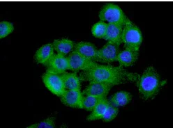 Immunocytochemistry/ Immunofluorescence - Anti-PERP antibody [EPR7885] (AB129083)