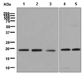 Western blot - Anti-PERP antibody [EPR7885] (AB129083), expandable thumbnail