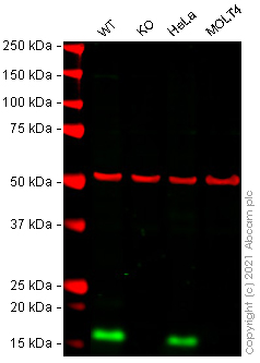 Western blot - Anti-PERP antibody [EPR7885] (AB129083), expandable thumbnail