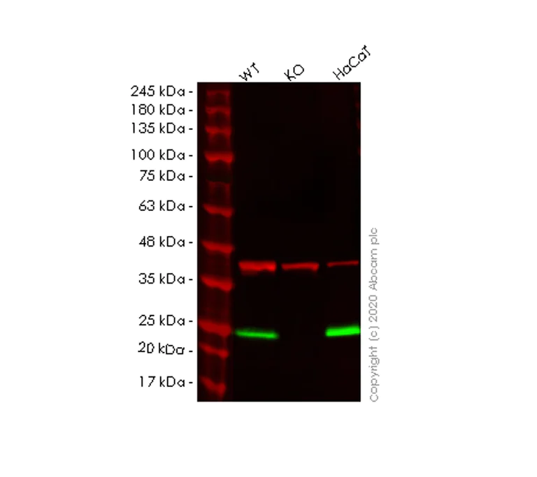 Western blot - Anti-PERP antibody [EPR7885] - BSA and Azide free (AB248288)