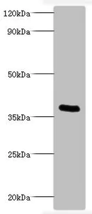 Western blot - Anti-Pertussis toxin antibody (AB193494)