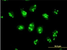Immunocytochemistry/ Immunofluorescence - Anti-Pescadillo antibody (AB88543)