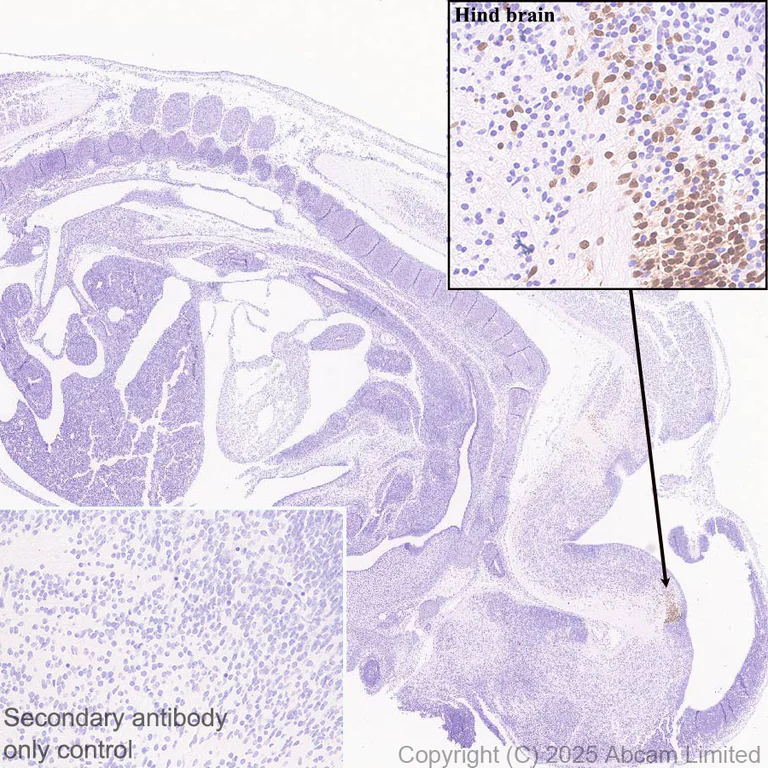 Immunohistochemistry (Formalin/PFA-fixed paraffin-embedded sections) - Anti-Pet1 antibody [EPR30322-523] (AB324873)