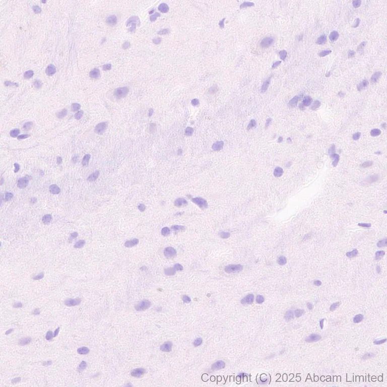 Immunohistochemistry (Formalin/PFA-fixed paraffin-embedded sections) - Anti-Pet1 antibody [EPR30322-523] (AB324873)