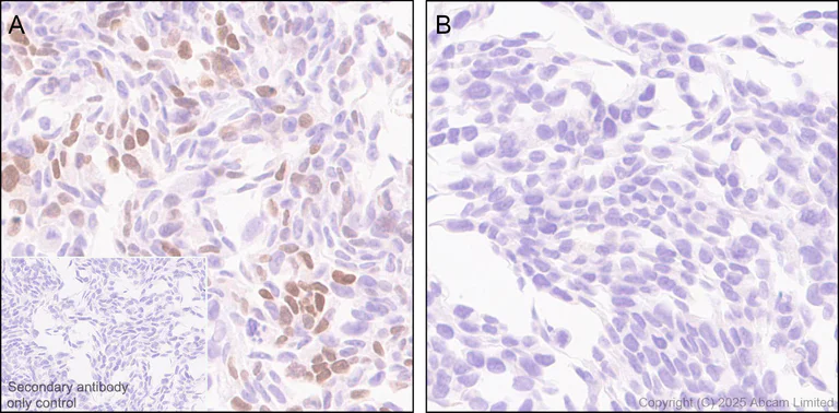 Immunohistochemistry (Formalin/PFA-fixed paraffin-embedded sections) - Anti-Pet1 antibody [EPR30322-523] (AB324873)
