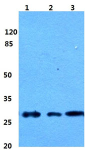 Western blot - Anti-PEX11B antibody (AB211508), expandable thumbnail