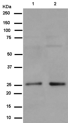 Western blot - Anti-PEX11B antibody [EPR12183] (AB181066)